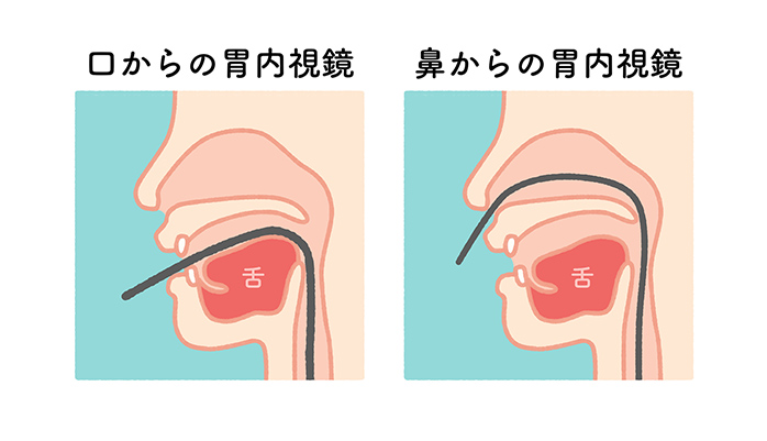 経口・経鼻内視鏡をご選択いただけます