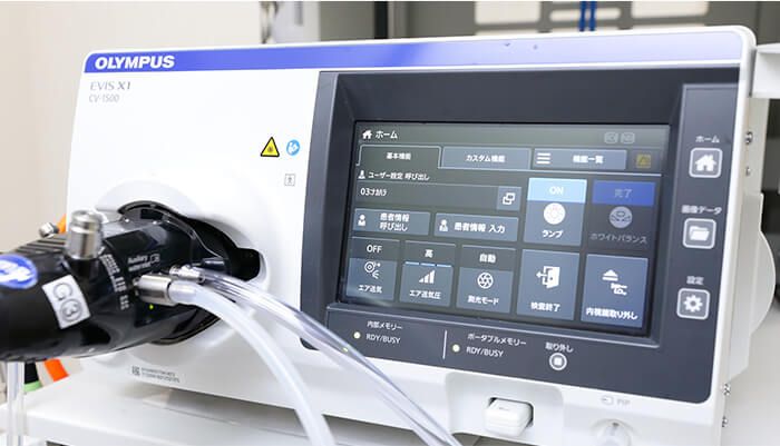 最先端の内視鏡システム「EVIS X1」を導入