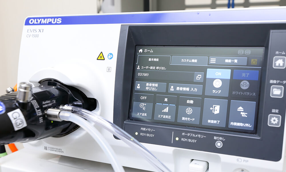 最先端の内視鏡システム「EVIS X1」を導入