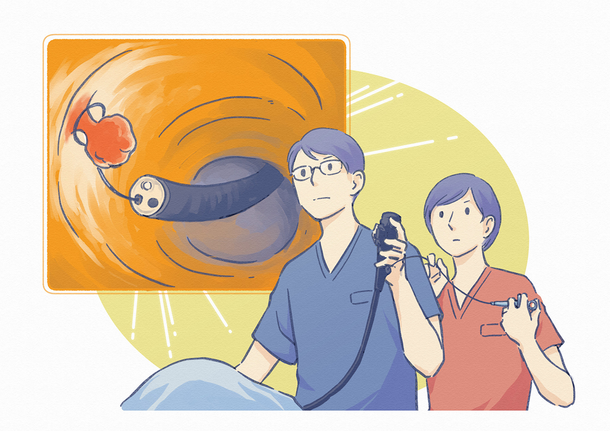 内視鏡検査イラスト