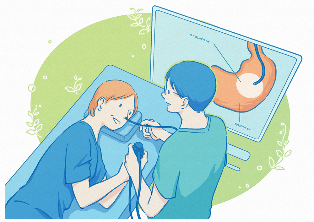 内視鏡検査イラスト